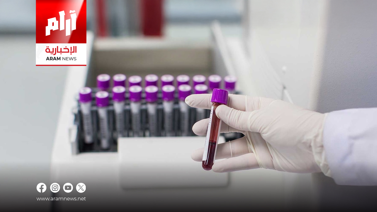 تفشي عدوى “المستدمية النزلية” في ألمانيا.. 3 وفيات وتحذيرات دولية